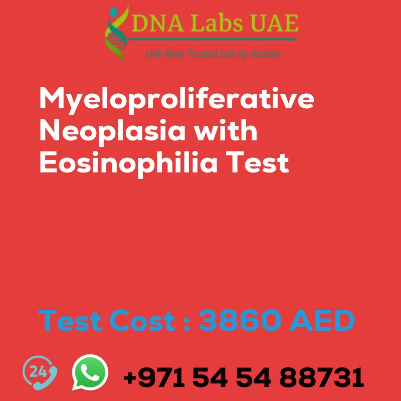 Myeloproliferative Neoplasia with Eosinophilia Test sale cost 3860 AED