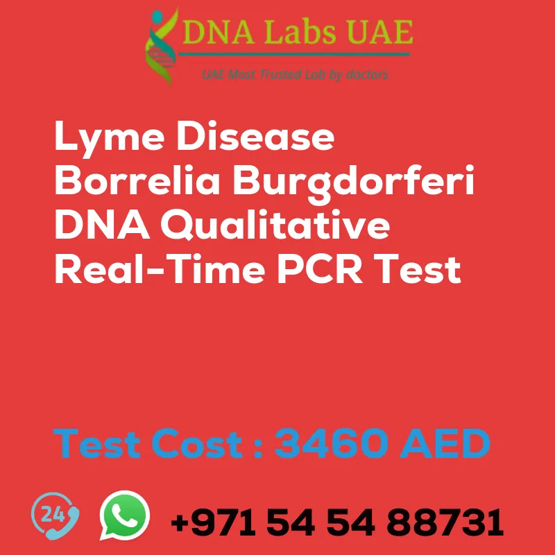Lyme Disease Borrelia Burgdorferi DNA Qualitative Real-Time PCR Test sale cost 3460 AED