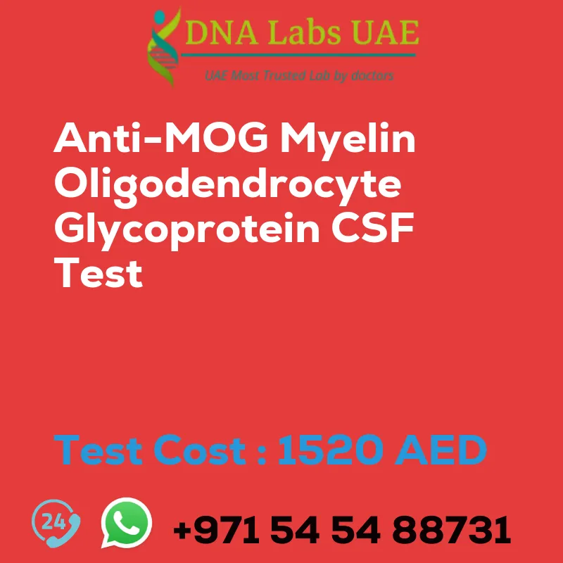 Anti-MOG Myelin Oligodendrocyte Glycoprotein CSF Test sale cost 1520 AED