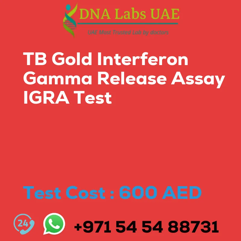 TB Gold Interferon Gamma Release Assay IGRA Test sale cost 600 AED