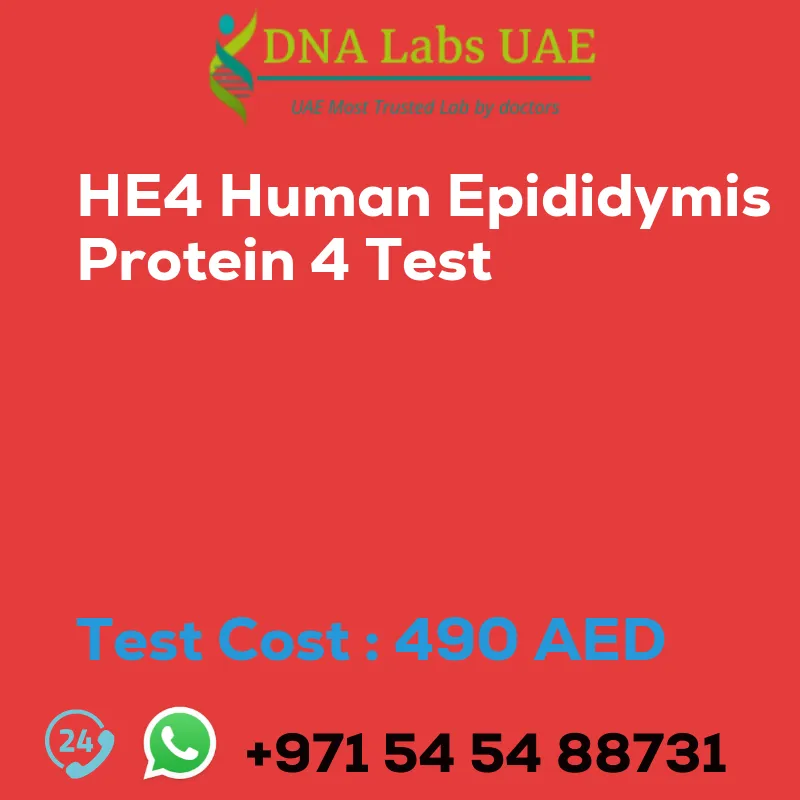 HE4 Human Epididymis Protein 4 Test sale cost 490 AED