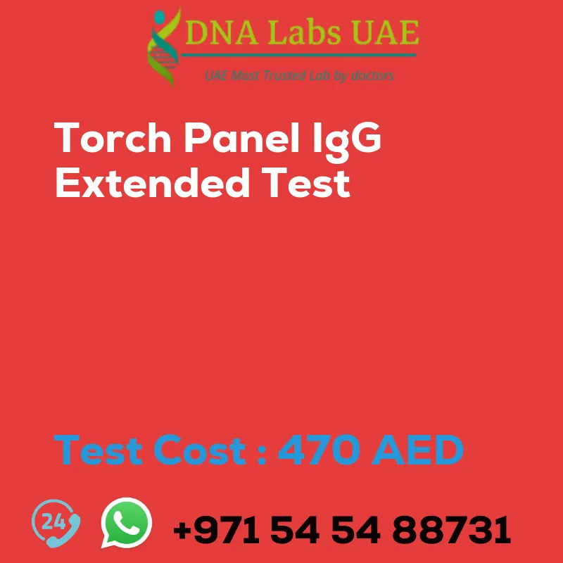 Torch Panel IgG Extended Test sale cost 470 AED